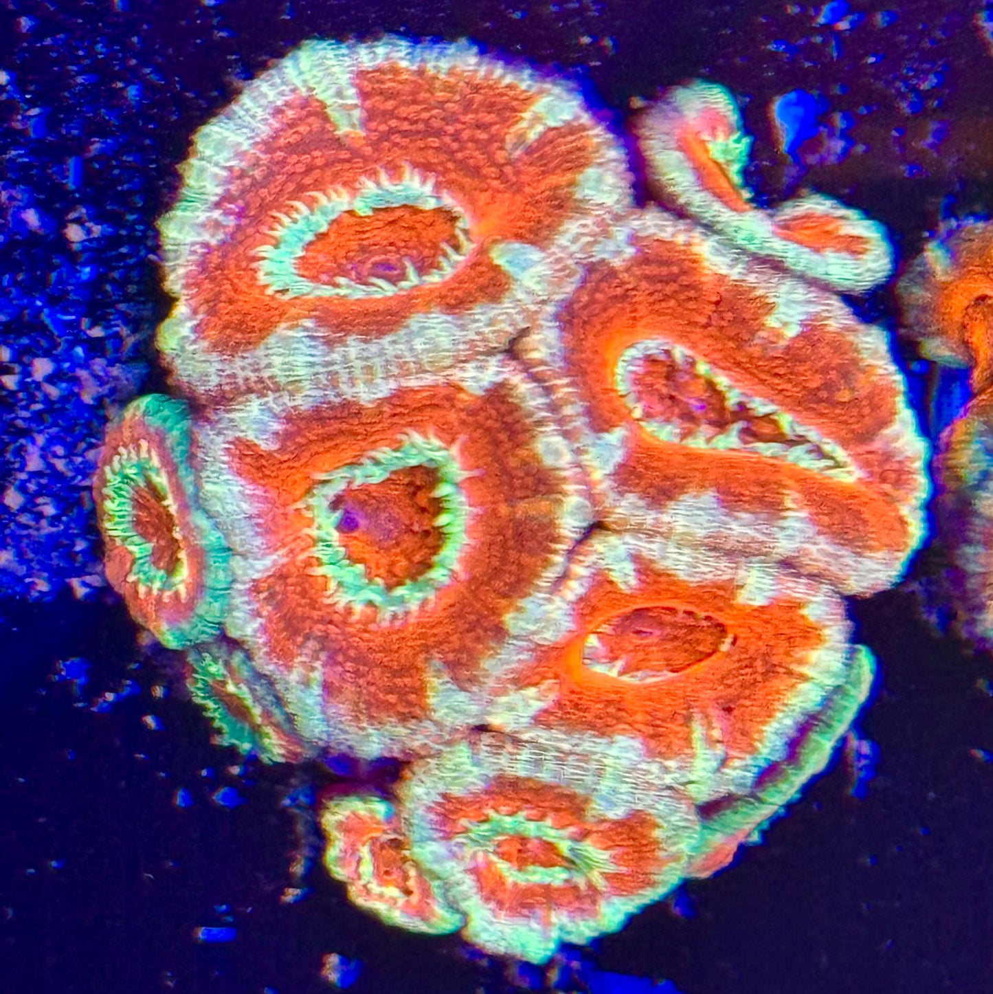 Ultra acan